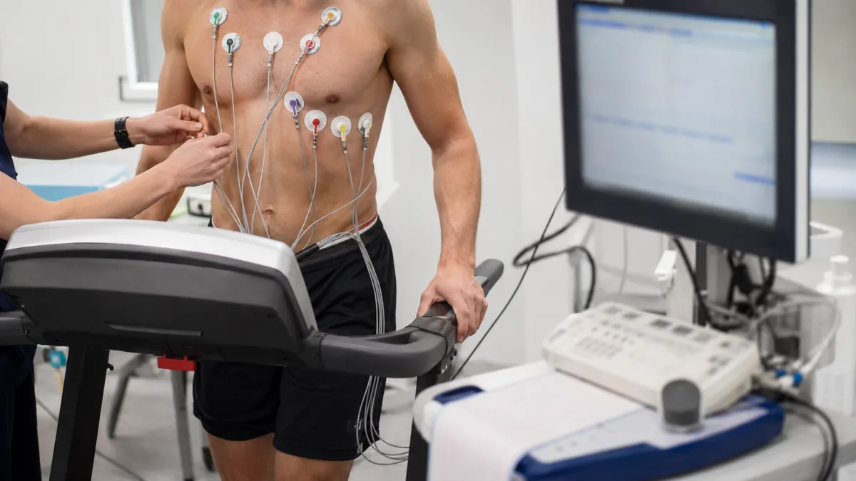 Supervised treadmill exercise test