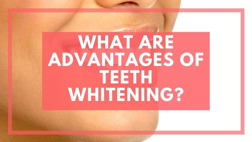 teeth whitening advantages