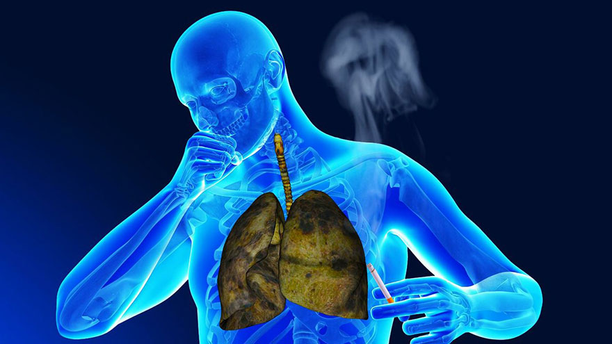 COPD Respiratory Failure