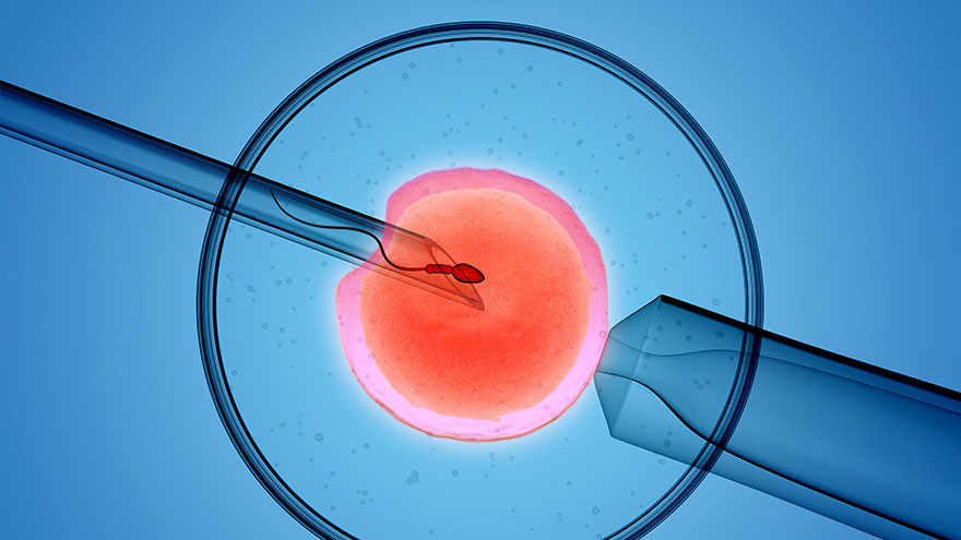 Artificial Insemination vs. IVF