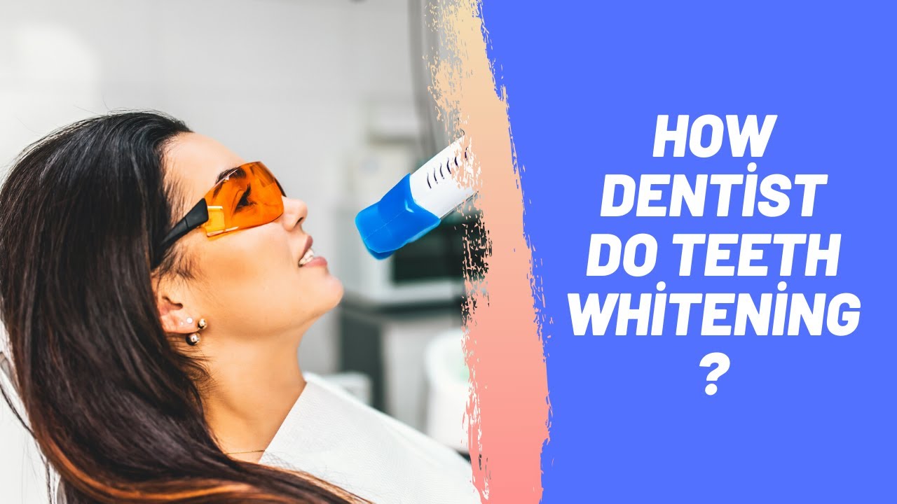 How Does Dentists Do Teeth Whitening?